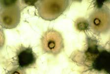 soon as 3 days after culturing, on either the tissue or the surrounding agar (Fig. 12). Immature pseudothecia also may form.