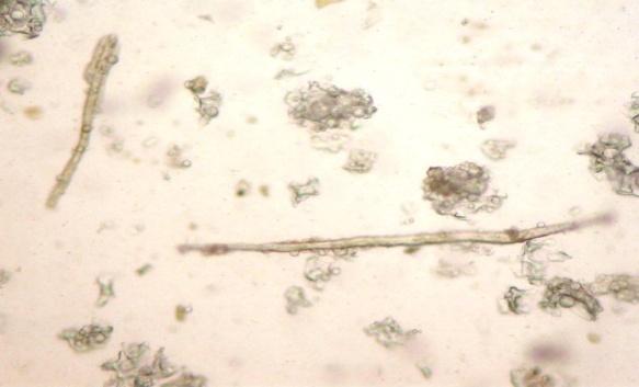 tissues With fibers, groups