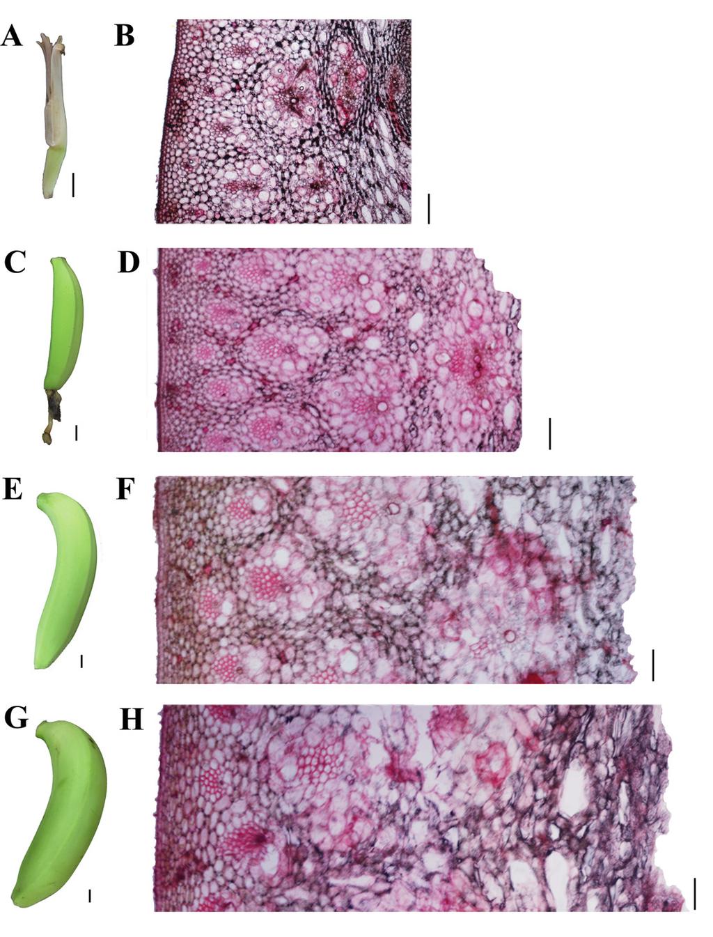 AMNUAYSIN ET AL. ANATOMICAL CHANGES IN PEEL STRUCTURE OF BANANA 131 Anatomical Peel Structure and Firmness of Hom Thong Banana During Maturation and Ripening.