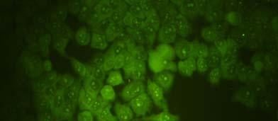 TẠP CHÍ PHÁT TRIỂN KH&CN, TẬP 11, SỐ 01-2008 So với mẫu tế bào không xử lí, tế bào xử lí với trau tráu tại 1 µg/ml trong 24 giờ có sự thay đổi hình thái khi quan sát dưới kính hiển vi soi ngược (hình