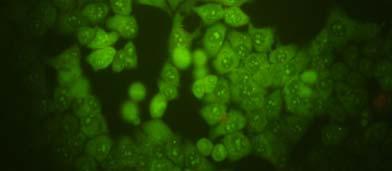 Sau đó, chúng tôi tiến hành nhuộm hai quần thể tế bào này đồng thời với hai loại thuốc nhuộm: AO và EB và quan sát dưới kính hiển vi huỳnh quang, các tế bào có cảm ứng với thuốc bắt màu xanh sáng và