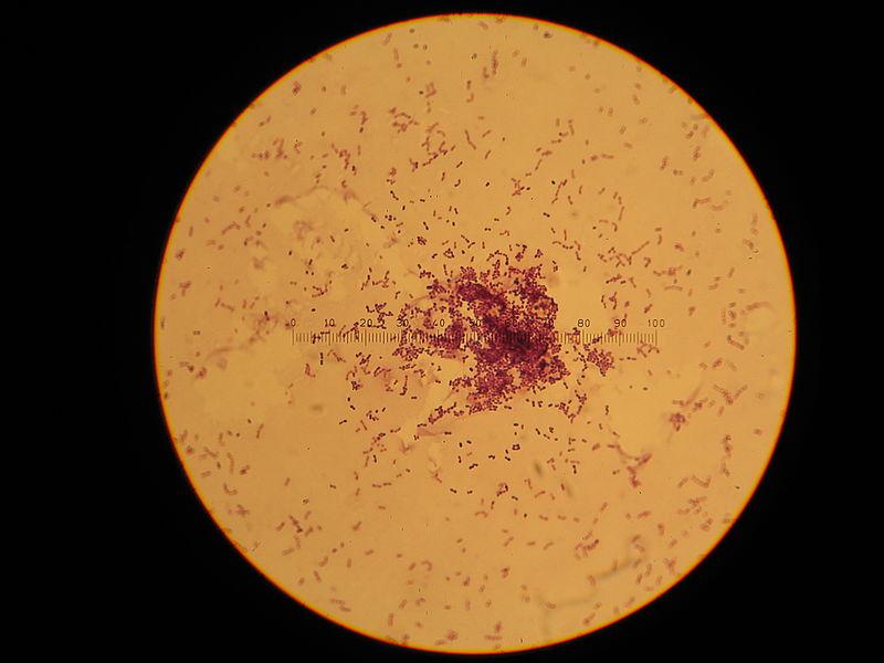 Lactococcus. lactis subsp. Cremoris Lactococcus subsp.