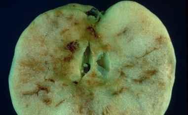 Fruit Pests and Diseases CONTROLLING APPLE MAGGOTS In the past years many homeowners with apple trees had crops of apples with the following symptoms: Winding trails in apple flesh Brown flesh
