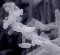 forming Saccharomyces inhibited by salt sugar fungus