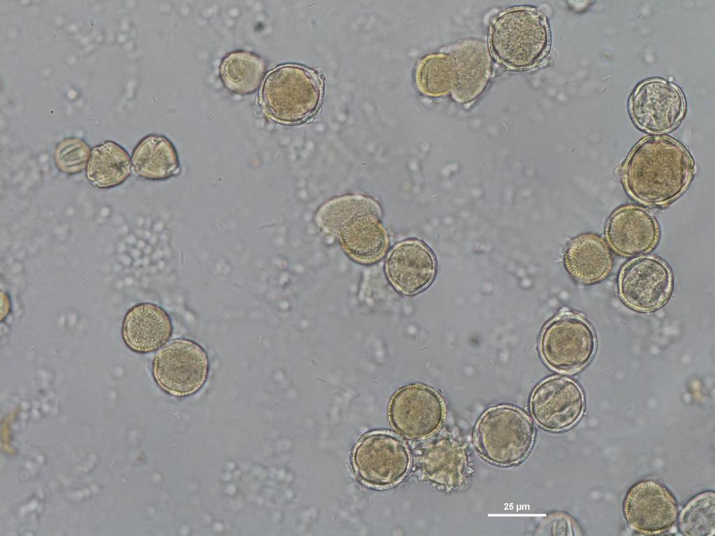 Pollen Spectrum of Citrus Honeys Anacardiaceae, Gleditsia-T, Celastraceae, Lonicera, Caryophyllaceae, Helianthus-T, Taraxacum-T, Compositae,
