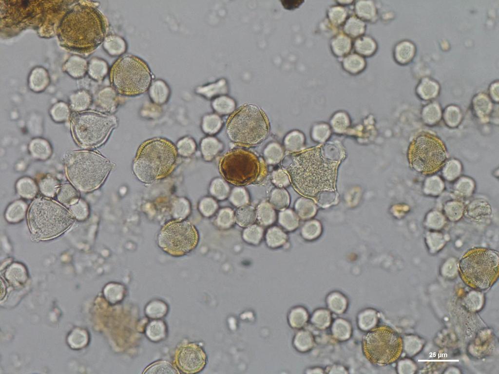 Pollen Spectrum of Astragalus Honeys Gleditsia-T, Caprifoliaceae,