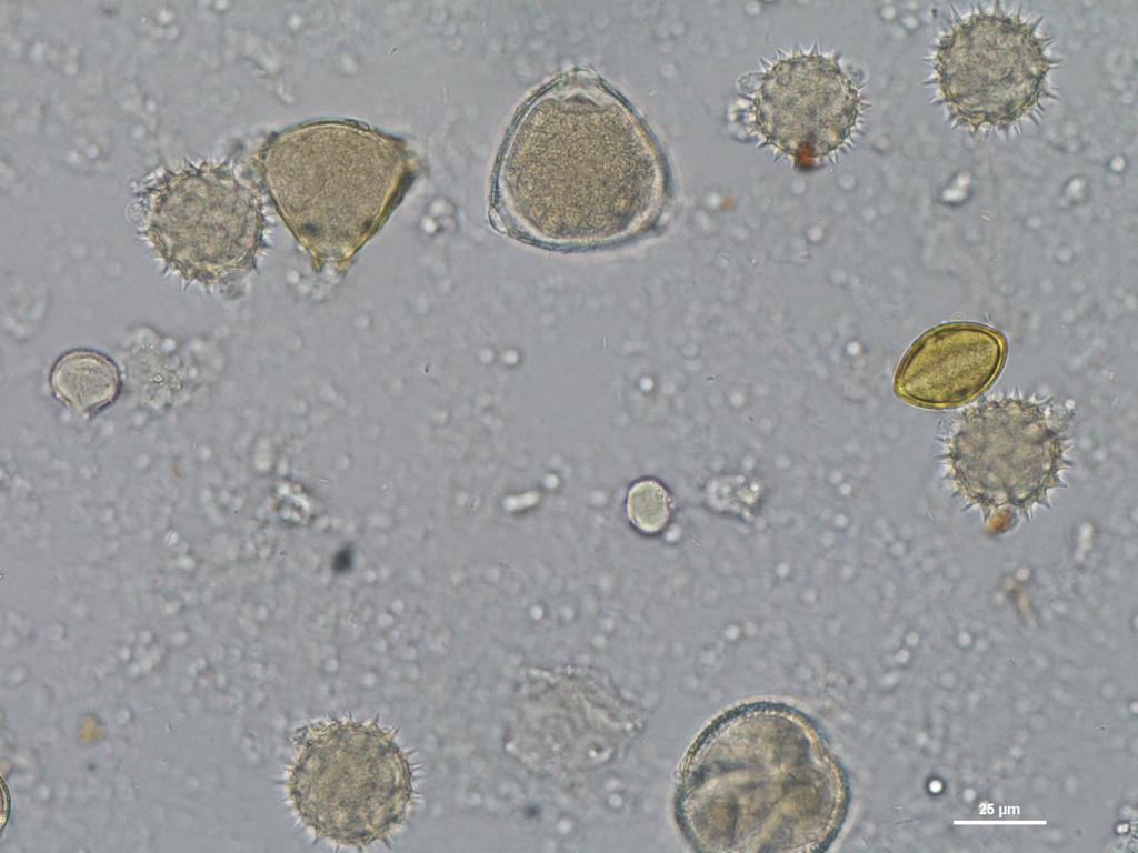 Pollen Spectrum of Helianthus Honeys Actinidia-T, Anacardiaceae, Chenopodiaceae, Crassulaceae, Artemisia, Carthamus-T, Helianthus-T, Taraxacum-T, Xanthium-T, Compositae, Cucumis, Cruciferae,