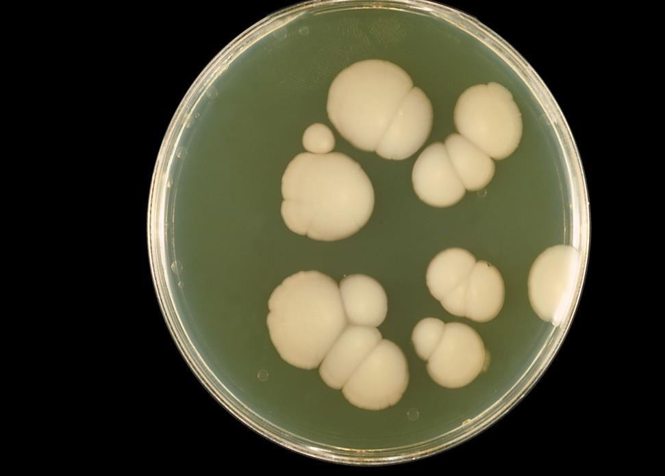 Candida albicans 10%KOH: budding yeast cells &