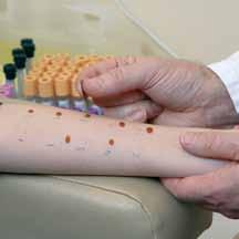 A tiny prick is then made in the skin so the allergens come into contact with tissues that can trigger an immune reaction.
