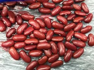 pictures from her Nebraska farm of dark red kidney beans and