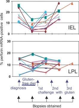 Gliadin dependent induction of cytotoxic IEL in celiac disease: Challenge with gluten leads to a dosedependent increase in the frequency of cells expressing perforin mrna in the mucosal compartment
