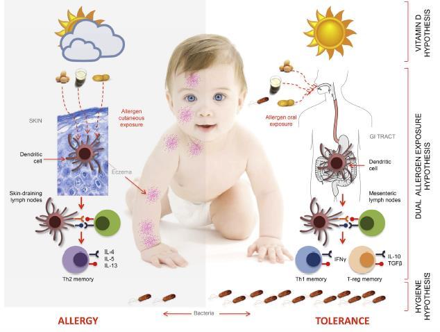 Allergy vs.