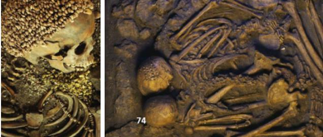 DOCUMENT L Figure (on left): The skeleton of an 18 year old male wears a shell hat and necklace in a burial at the Mesolithic site of Arene Candide in Italy.