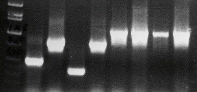 Higher tech PCR Analysis of DNA by Polymerase Chain Reaction (PCR) is generally useful for identification of genus and, sometimes, species of fungi.