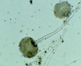 Aspergillus niger Curvularia luna Fusarium oxysporum (4) (5) (6) Mucor globossum Penicillium chrysogenum Rhizopus spp (7) (8) (9) Minimum number of extra-aquatic and