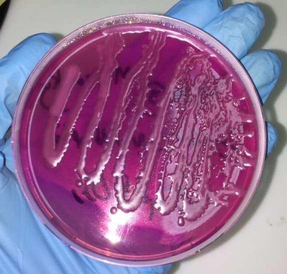 Zainab Salim Jaafar Fig. (3): E.coli on MacConkey agar Streak plate isolation of E.