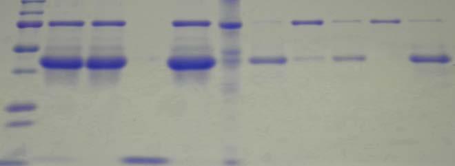 Figure 1: SDS-PAGE of egg white proteins collected over the sequential separation steps.