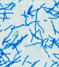 What Is Lactobacillus? Gram-positive facultative anaerobic (preferring no oxygen) rod-shaped bacteria.