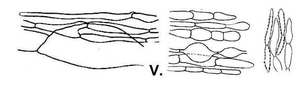 (12,5-) 13,7-18,7 (-20) x 7-9,5 µm. Ch. 22-82 x 6,8-16,5 (-22) µm. Parasola conopileus (FR.: FR.) ÖRSTADIUS & E. LARSS. (Syn.: Psathyrella conopileus (FR.) ULBR.