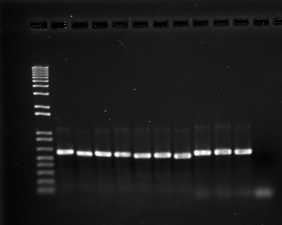 DNA extraction PCR