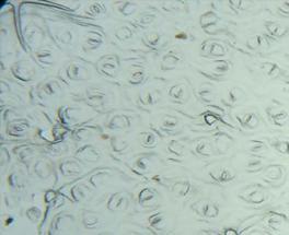 The number of stomata was count in an area with highest stomatal density.