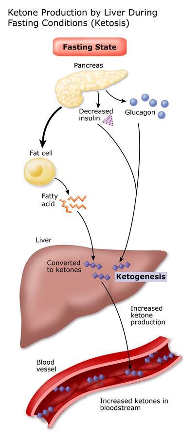 Ketosis Ketosis - is achieved through the reduction of carbohydrate intake where the body makes a