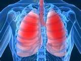Types of Reactions Respiratory -Coughing -Wheezing -Throat tightness -Trouble breathing -Children