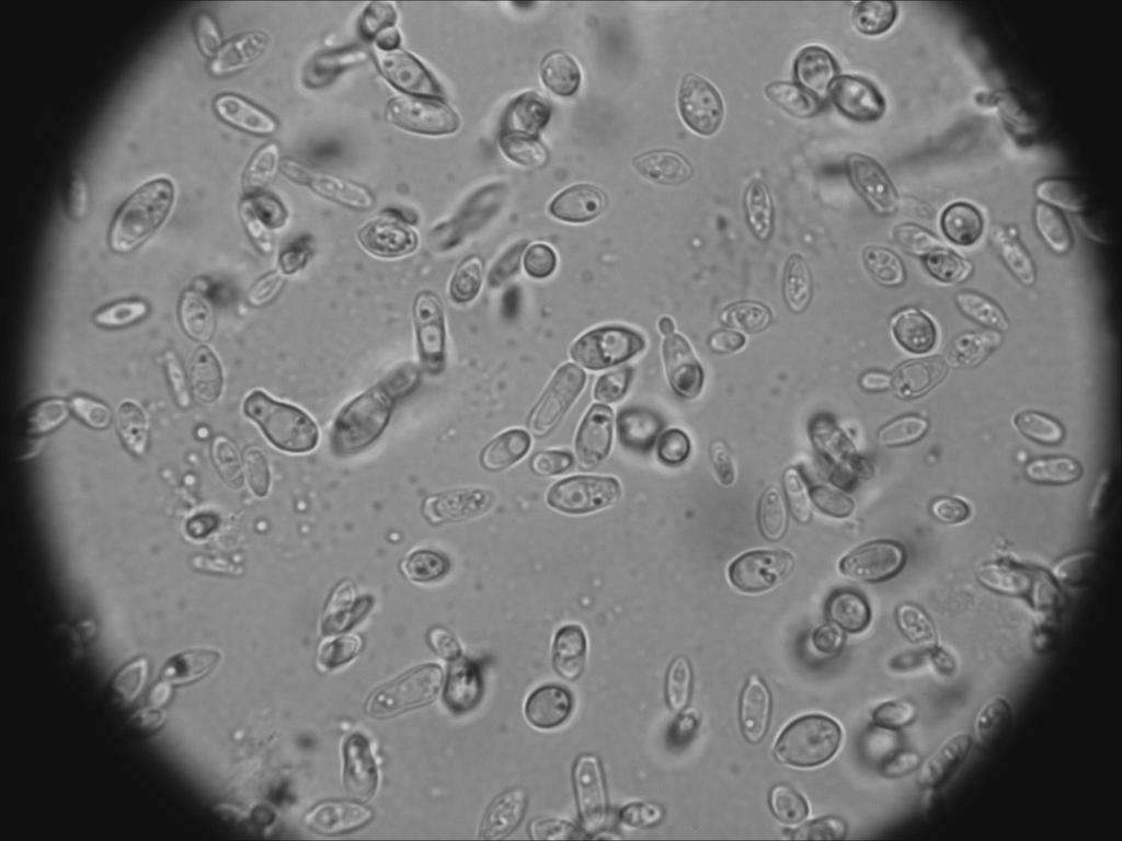 brett taint prevention Brettanomyces is an unwanted yeast that can develop in wines after fermentation of red wines Classic: SO2 addition or flash