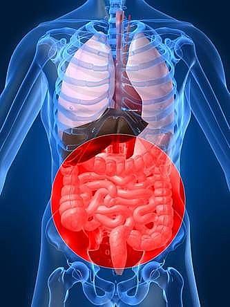 SYMPTOMS Typical Celiac Disease Recurrent abdominal pain Constipation