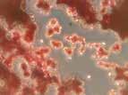 Zygosaccharomyces confirmed by conjugation Special Microbiological Services and Identification Services: Cause of spoilage and/or sediment Examination of colonies grown elsewhere Confirmation of