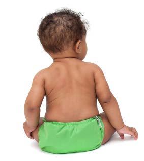 Diarrhoea in Infants Milk allergy Other