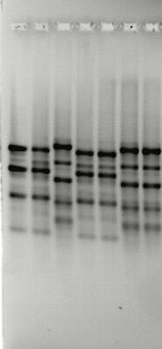 Chapter 4: Mycotoxin-producing Fusarium in traditional tempeh and usar Samples no 1-15 from left to right Figure 2. Some results of DNA fingerprinting from Fusarium isolates. B25.