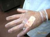 When Should a Food Worker Choose a Glove Barrier?