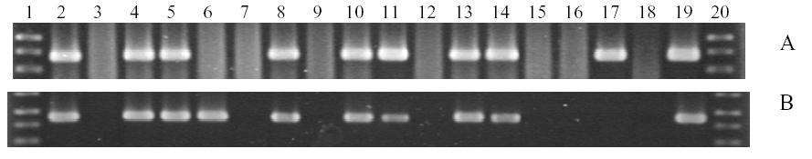 S.FERRER ET AL., BACTERIA AND THEIR INFLUENCE ON BIOGENIC AMINES, PAG. 4 Figure 2. Determination of the HDC gene with the primers JV16HC/JV17HC (A) and CL1mod/JV17HC (B).