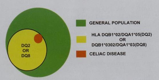 Genetic Markers in Celiac HLA DQ 2 and 8 All