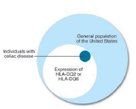 Genetic Factors: HLA + Other Genes Plus Environmental Factors Increased frequency of HLA haplotypes DR3-DQ2 DR5/7-DQ2 DR4-DQ8 70% concordance in MZ twins 10-15% prevalence in first degree relatives