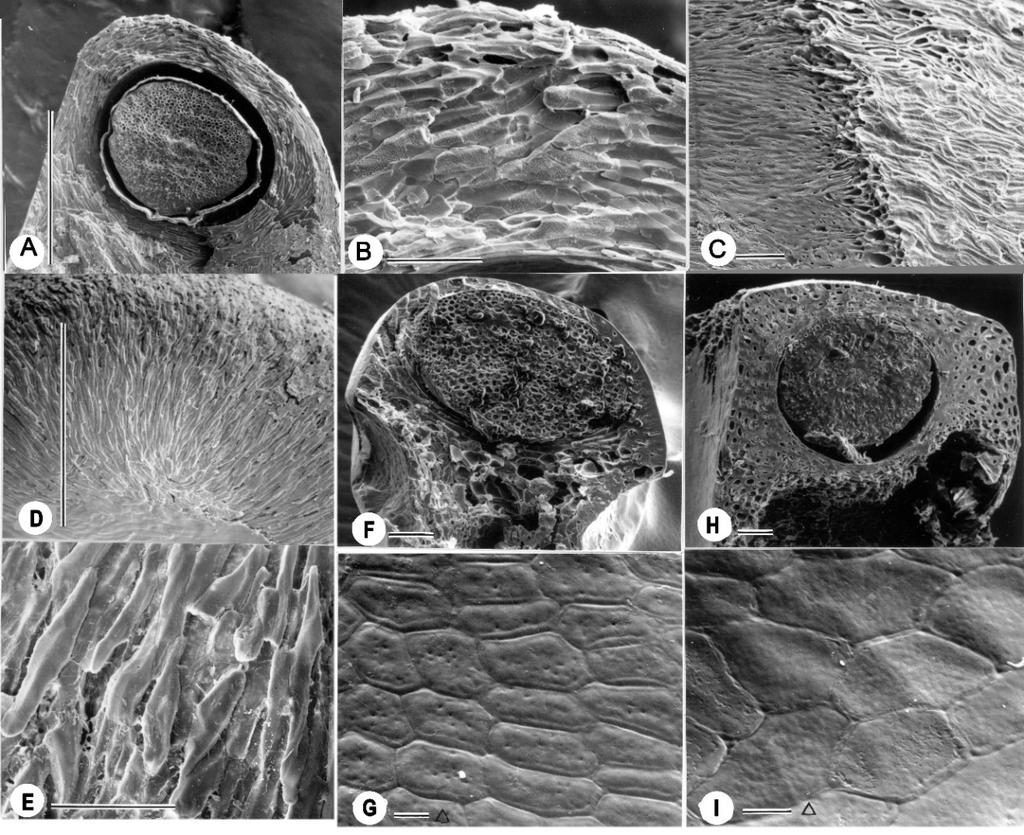2017 PSIDIUM IN BAHIA, BRAZIL 11 Fig. 3. SEM photographs of seed coats or Psidium, Calycolpus and Mosiera. A C. P. acidum: section of seed showing cylindrical cavity and embryo (A), upper portion of seed coat in section (B), and outer surface of seed on right and tangential section (C).