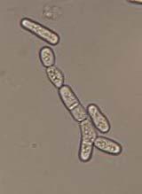 Schizosaccharomyces pombe mixed