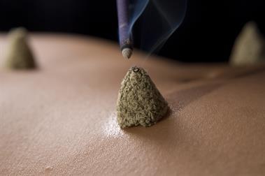 Moxhibustion A small cone of powdered leaves or sticks (called a moxa) is placed on the skin and set on fire.