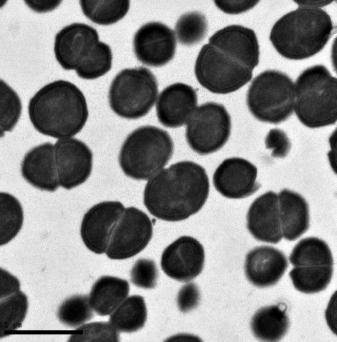 Epifluorescence micrographs (40x) of Pediococcus