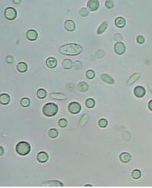 8 mm Spherical globular and oval cells. Unipolar bud. Singular cells.