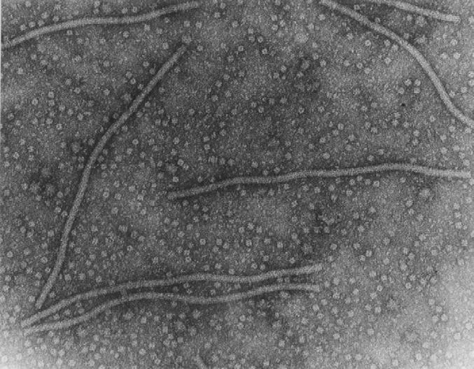 Rugose wood disease complex Rupestris stem pitting-associated virus