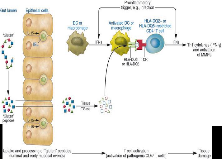 10 Altered permeability of epithelial cell layer enhanced by gliadinstimulated release of