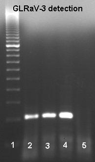Figure 6-1 RT-PCR test showing in lane 1 DNA ruler, lanes 2