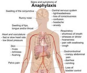 Symptoms of Anaphylaxis Tingling sensation in the mouth Swelling of the tongue and throat Difficulty