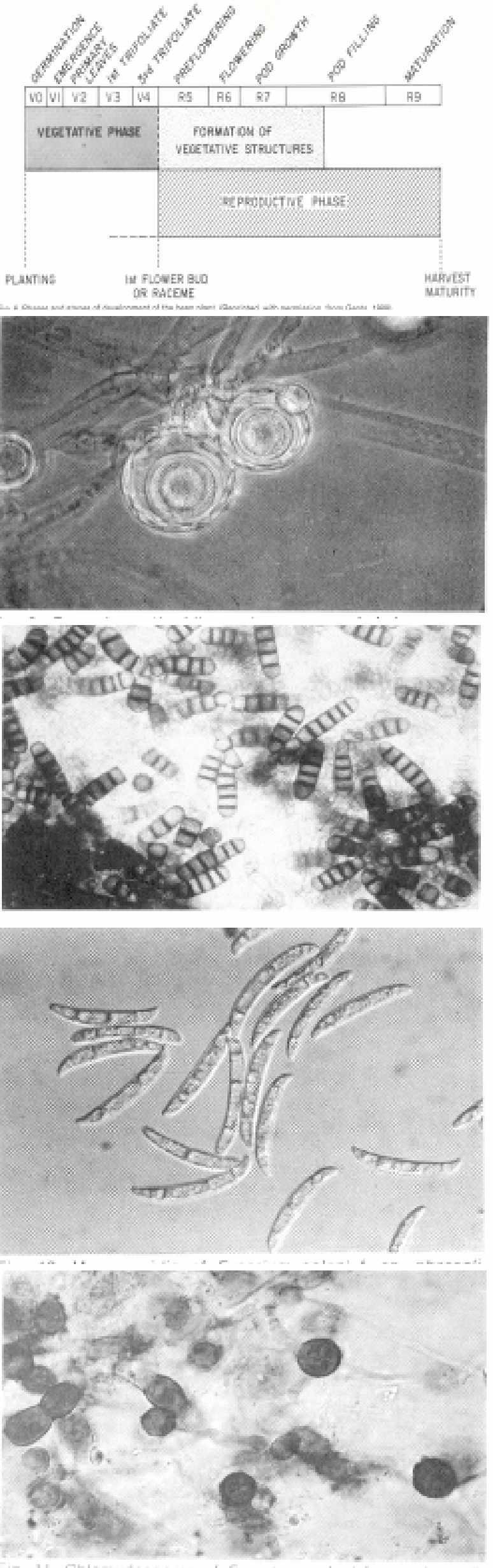 5 Phase and stages of development of the bean plant 6 Oogonia, antheridia and oospores of Aphanomyces euteiches f.