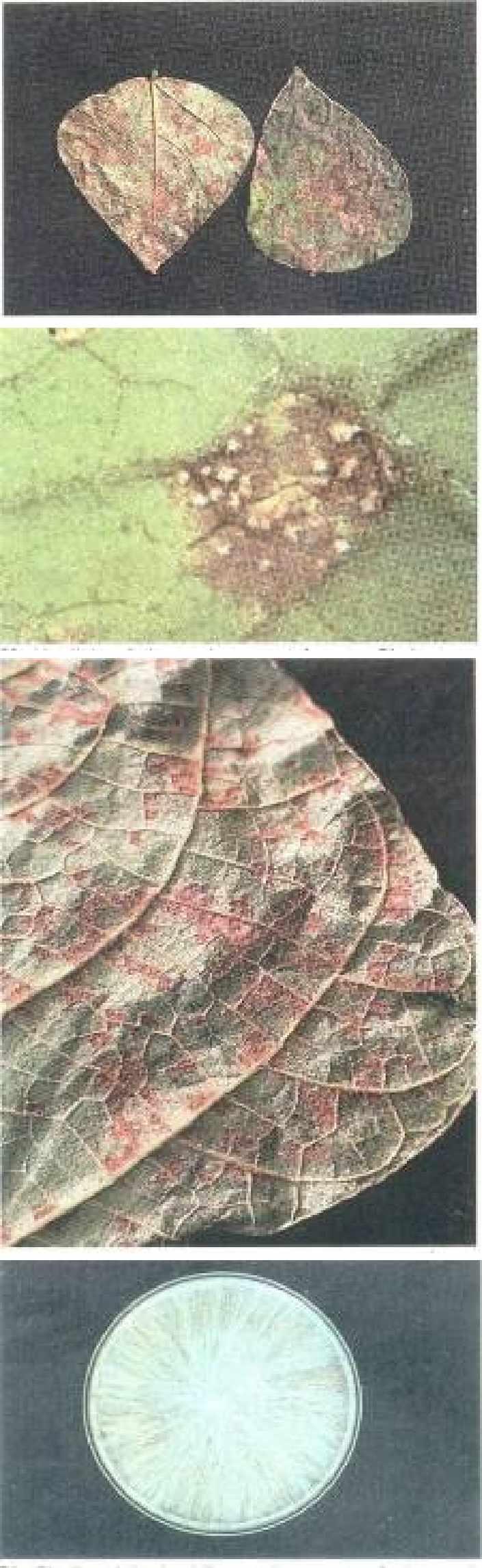 80 Soybean rust on leaf, caused by Phakopsora pachyrhizi 81 Uredinia of the soybean rust fungus Phakopsora pachyrhizi 82