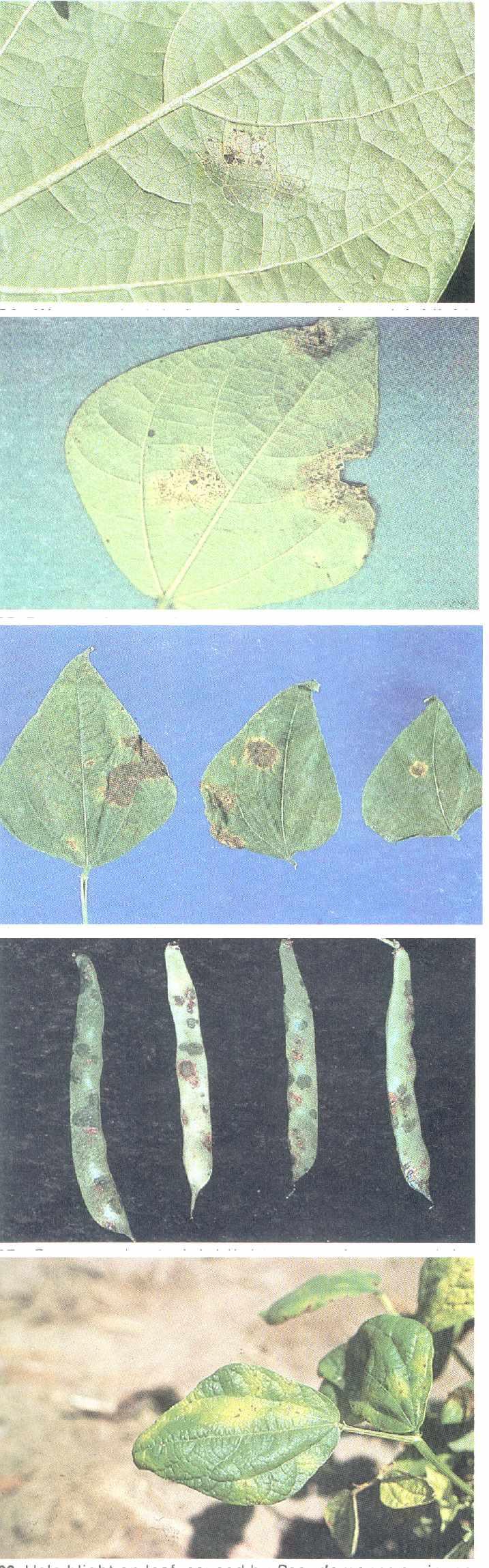 96 Water-soaked lesion of common bacterial blight, caused by Xanthomonas campestris pv. Phaseoli. 97 Common bacterial blight on lower leaf surface, caused by Xanphomonas campestris pv.