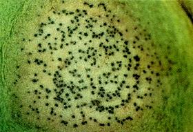 Blackleg: Leptosphaeria maculans Whitish, round to irregular
