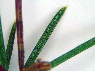 This needle appears to show signs of both Rhizosphaera and Stigmina